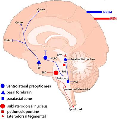 Sleep deprivation and NLRP3 inflammasome: Is there a causal relationship?